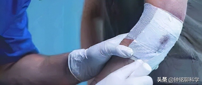 铔嗚櫕涓轰粈涔堣兘娌荤枟婧冪儌浼ゅ彛,铔嗚櫕鑳芥不鐤椾激鍙ｆ劅鏌撳悧