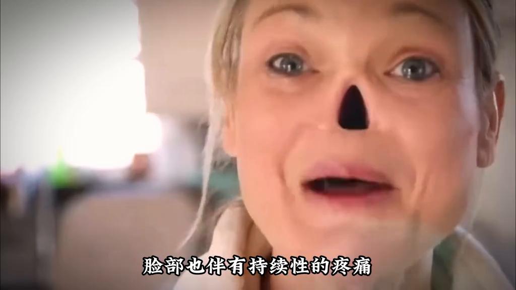 没有鼻孔的人长什么样,没有鼻孔的人视频