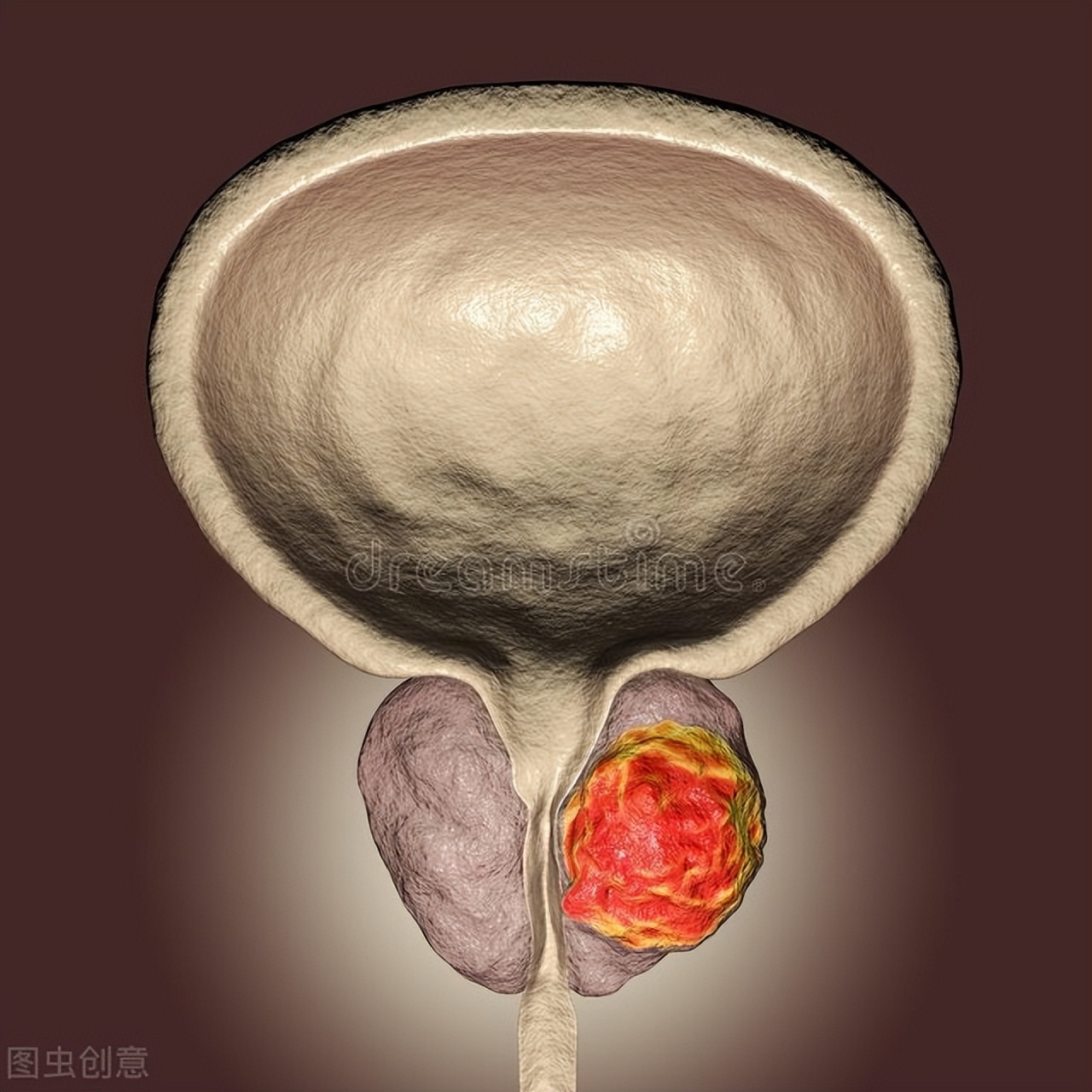 附睾炎疼痛是怎么回事,左侧附睾炎隐隐作痛会自愈吗