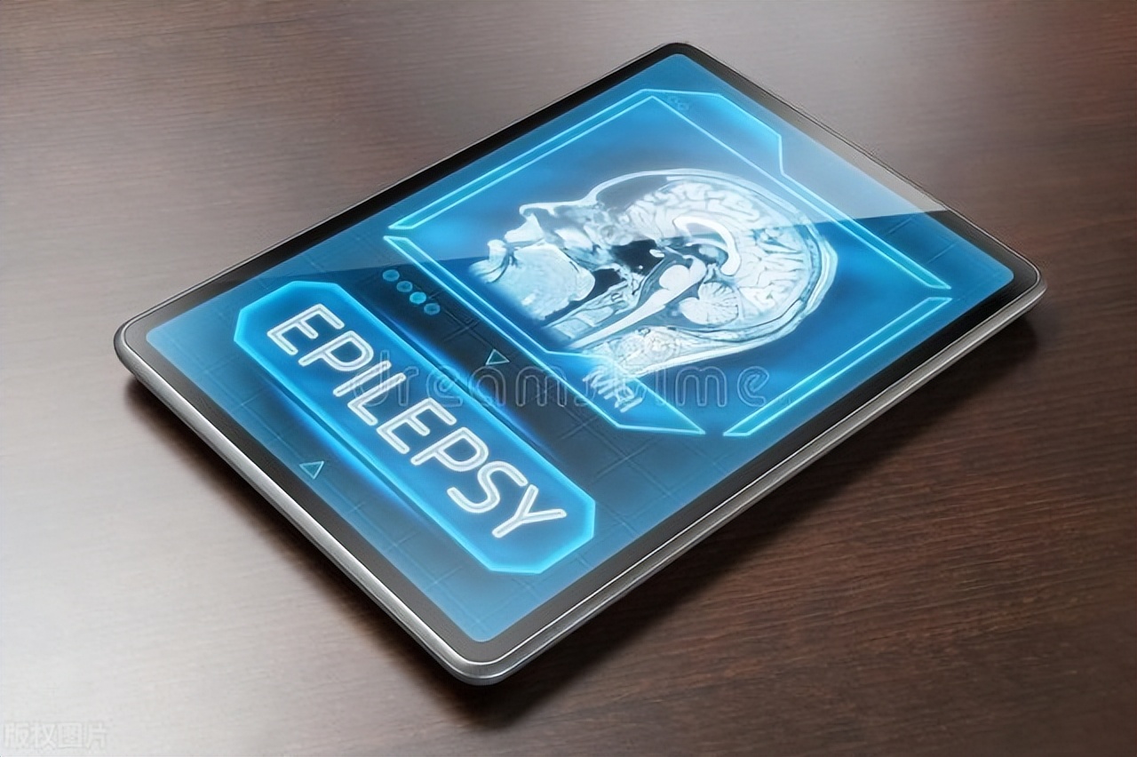 癫痫这种病是怎么来的,癫痫是什么样的病症