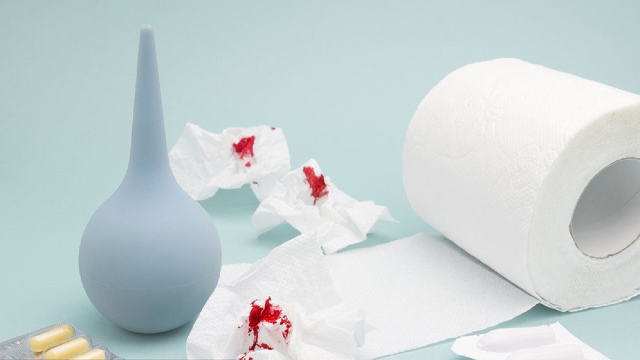 女性哪些生活习惯会引发肛裂,18岁女孩肛裂是什么毛病引起的