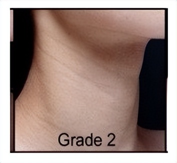 不要让颈纹出卖了你的年纪,不要让颈纹出卖你的年纪