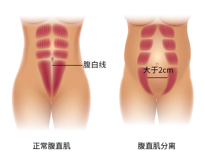 产后5周应该怎么做,产后第6周产妇需要注意哪些事项
