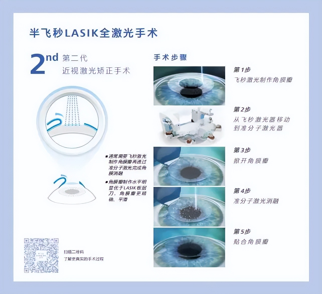 全飞秒和半飞秒近视手术如何选择,近视全飞秒和半飞秒手术哪个好点