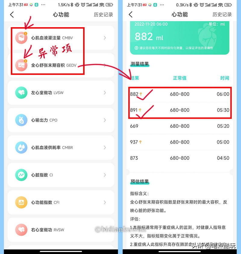 无需扎手检测血糖手表,无需采血自动测糖仪