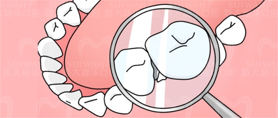 担心孩子牙长不好？青少年儿童口腔定期检查全攻略来了！