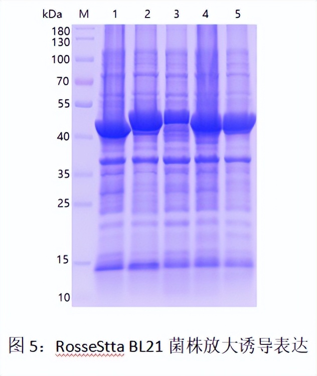 原核表达重组蛋白原理,高中原核蛋白翻译过程