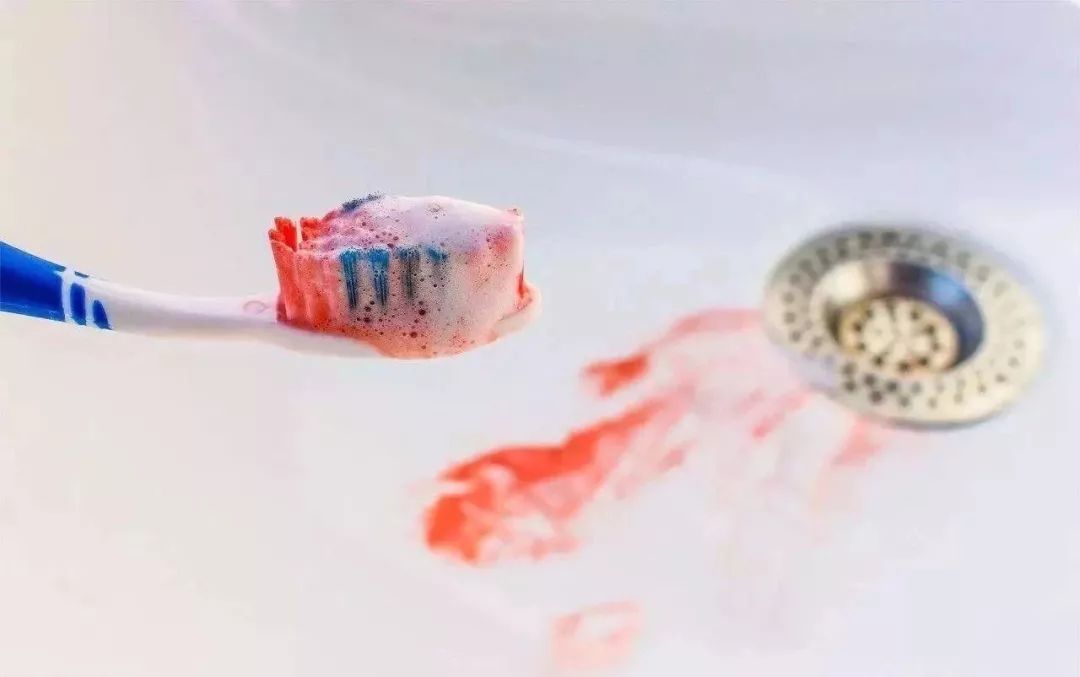 老是牙龈出血该吃什么药,牙龈老是出血不管行不行