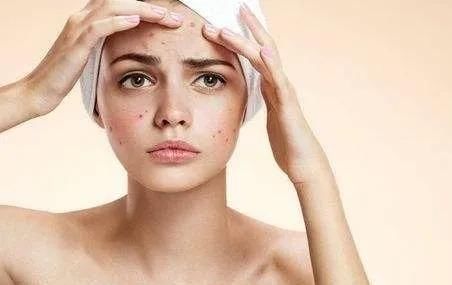 额头一直反复长痘什么原因,额头上老长痘反反复复的怎么回事