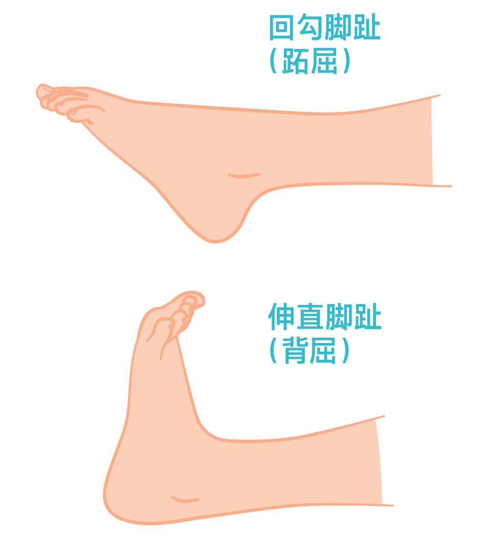 锻炼脚底跟腱的方法有哪些,足部跟腱拉伸的好处
