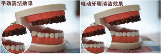 华为电动牙刷的优缺点,智能电动牙刷优缺点