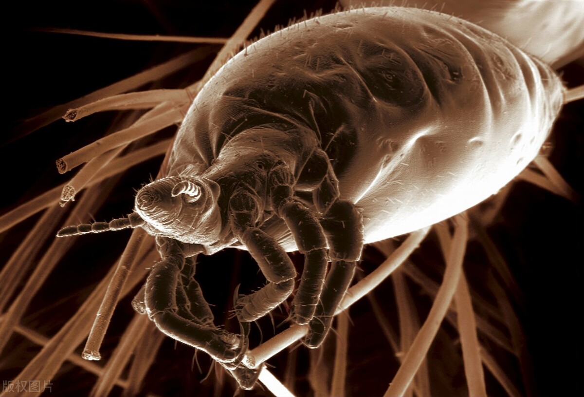 男子阴虱,男子阴虱病