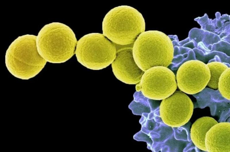 怎么避免金黄色葡萄球菌感染,金黄色葡萄球菌感染会致命吗