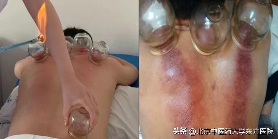 北京东方中医医院有哪几个院区,北京中医药大学东方医院就诊流程