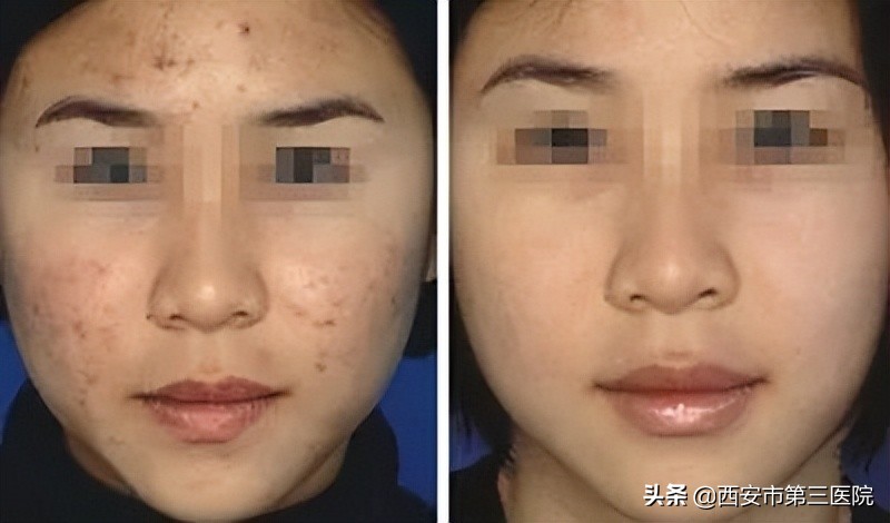 变美从这里开始英文,变美从皮肤开始