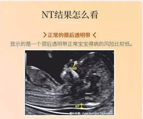 孕期孕检全攻略,厦门生娃产检全攻略