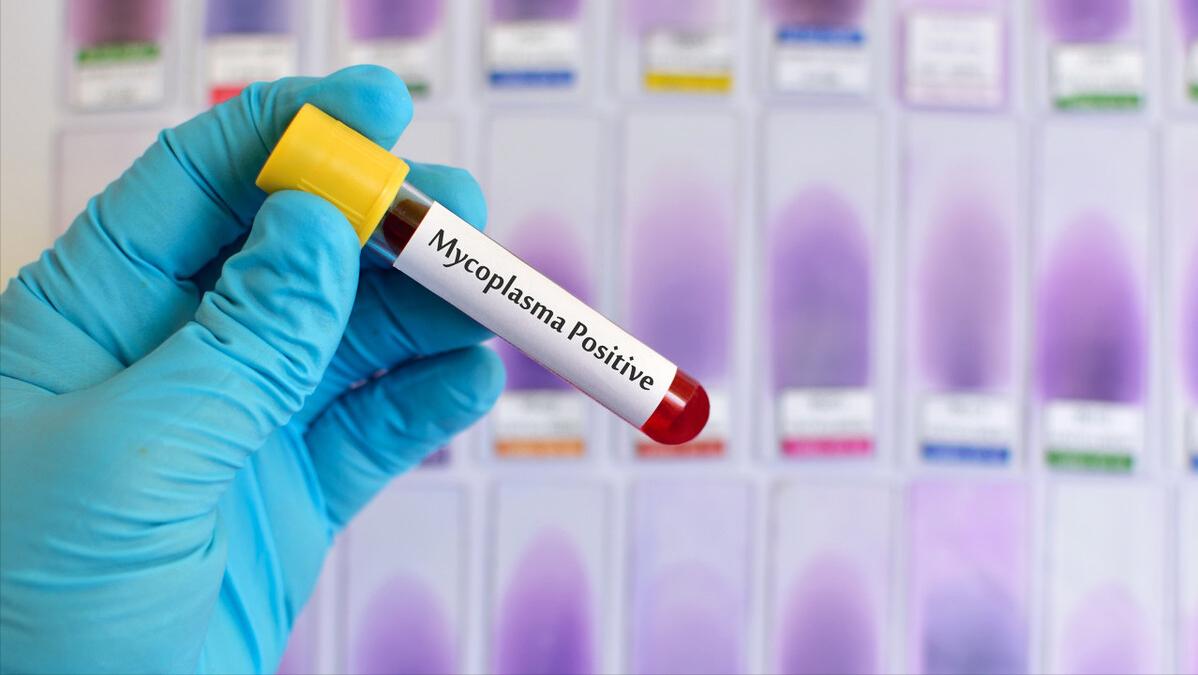 备孕前发现“支原体阳性”，对怀孕影响大吗？别怕，医生帮你应对