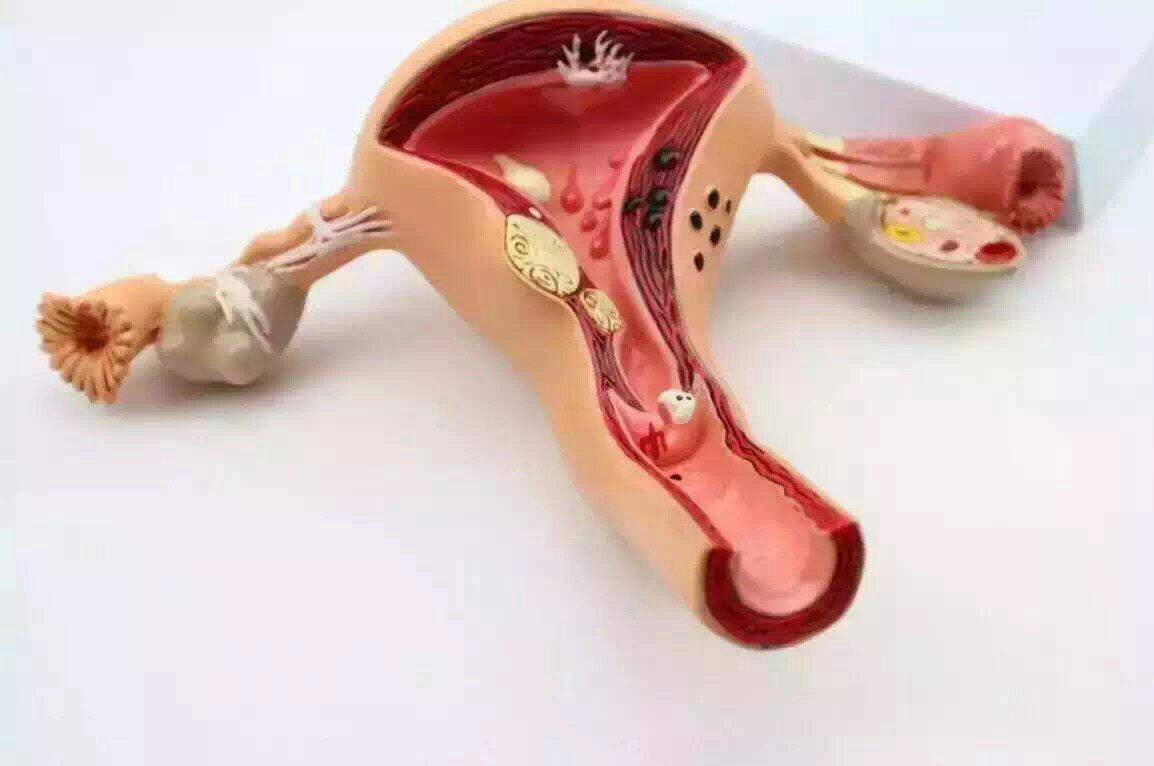 女性切除子宫后能干重活吗,女性切除子宫以后还能来月经吗