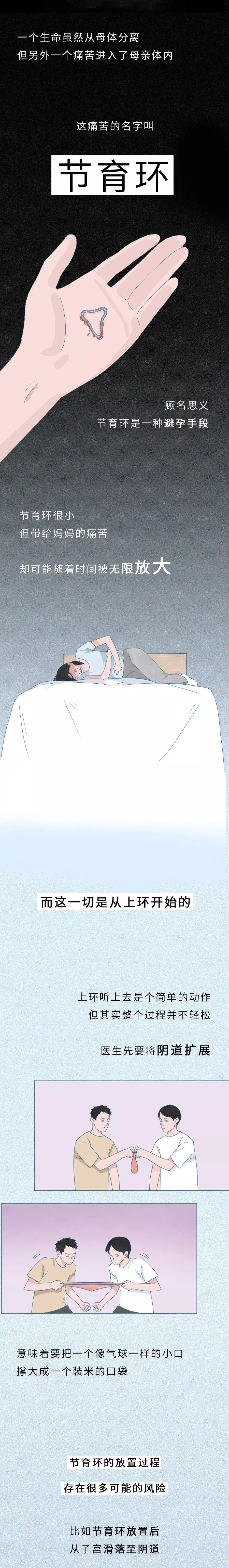 30多年节育环在体内是什么样的,节育环20年的是什么样子的