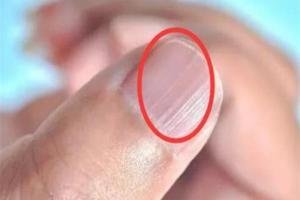 肝部麻木是什么原因,口苦眼干涩肝的问题怎么调理