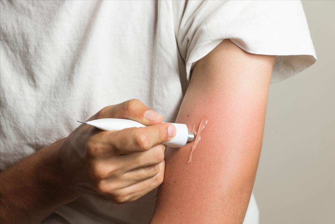 红霉素软膏的作用多少钱一盒,几块钱一支的红霉素软膏