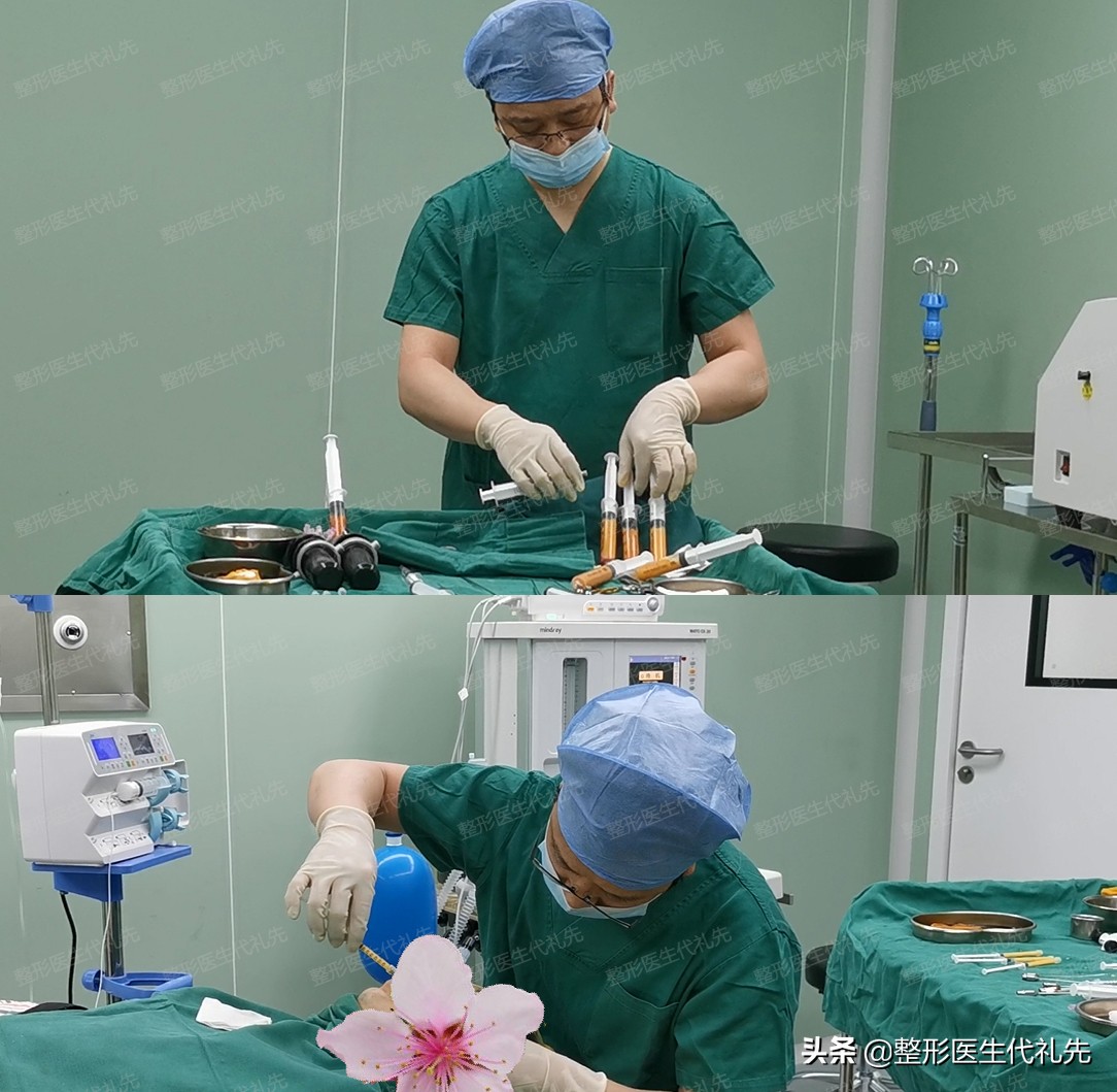 脸宽面部凹陷整形能恢复吗,面部皮肤下垂怎样整形修复