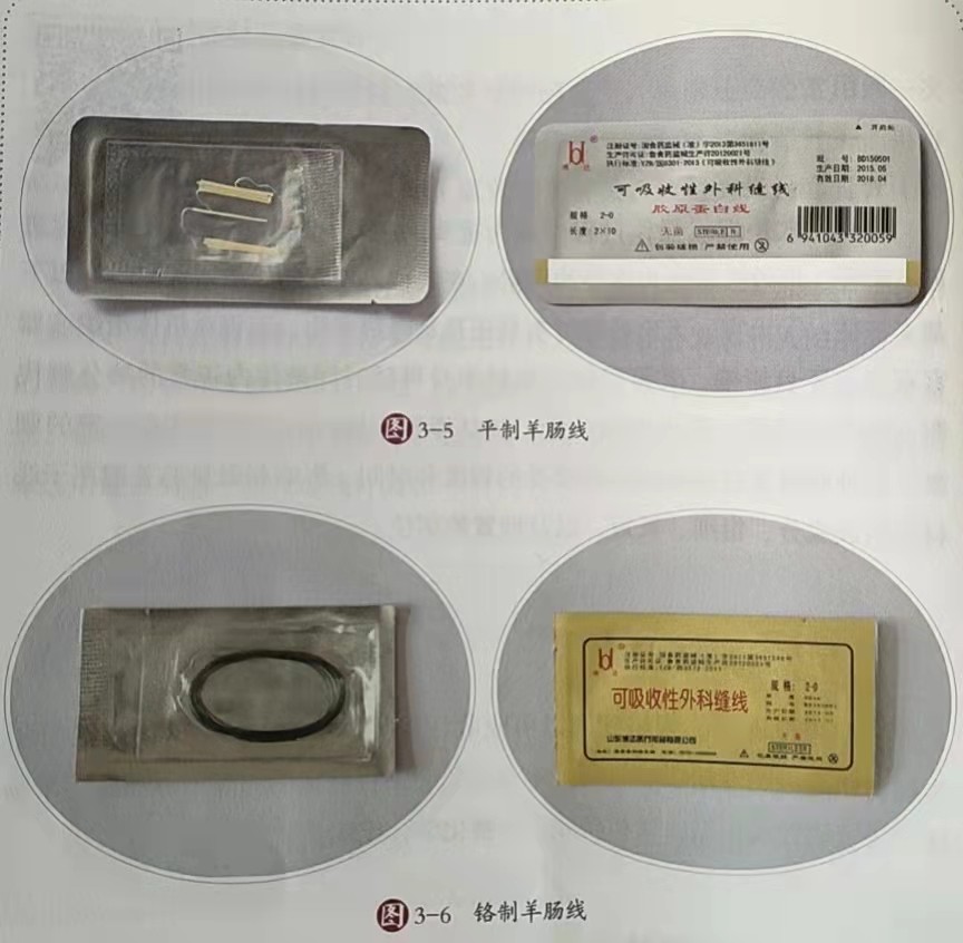 穴位埋线疗法副作用,穴位埋线疗法最有名的书