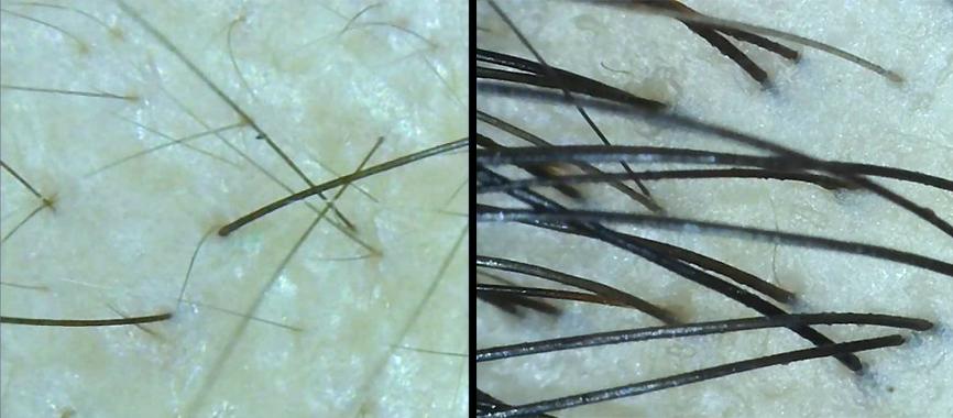 试错后重生,试错了一次又一次