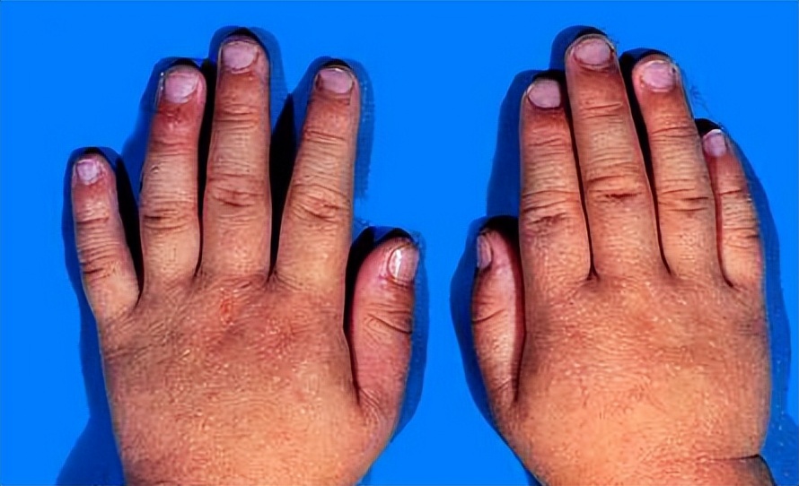 医疗美容和皮肤科的区别,医疗美容与微整形