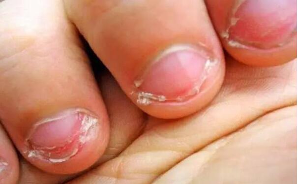 4岁小孩总吃手会怎么样,孩子4岁了还吃手