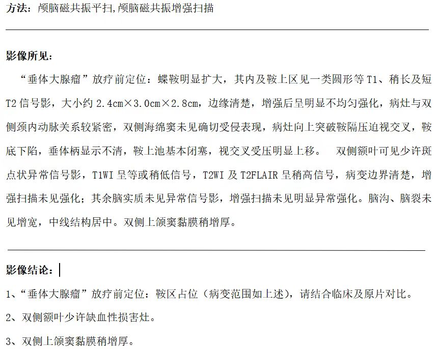 垂体瘤患者放射治疗能彻底治愈吗,垂体瘤术后有残留伽玛刀能切除吗