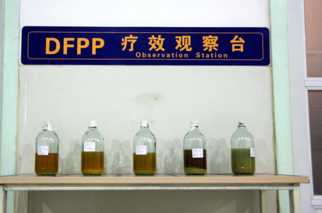 逆转肾病最新疗法,逆转肾脏纤维化