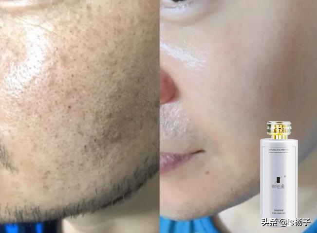 如何变白皮肤最快最有效1天,皮肤怎样变白最快最有效去暗黄