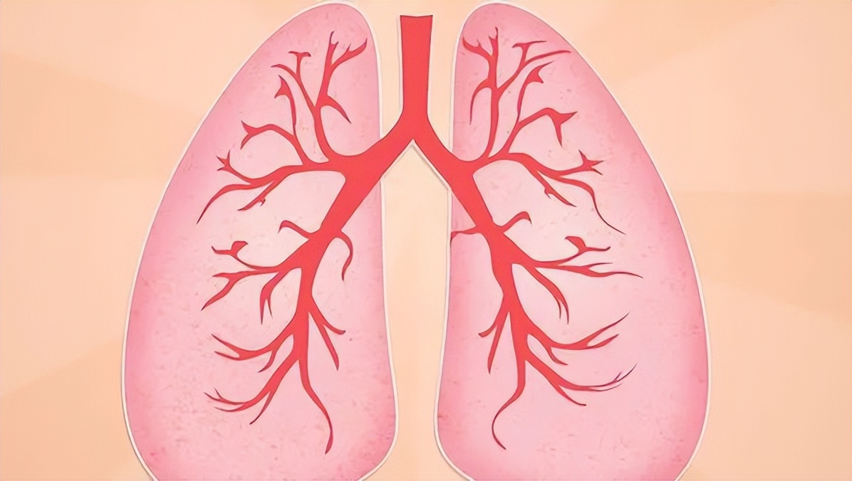咳嗽痰多晚上发烧怎么回事,经常咳嗽需警惕哮喘