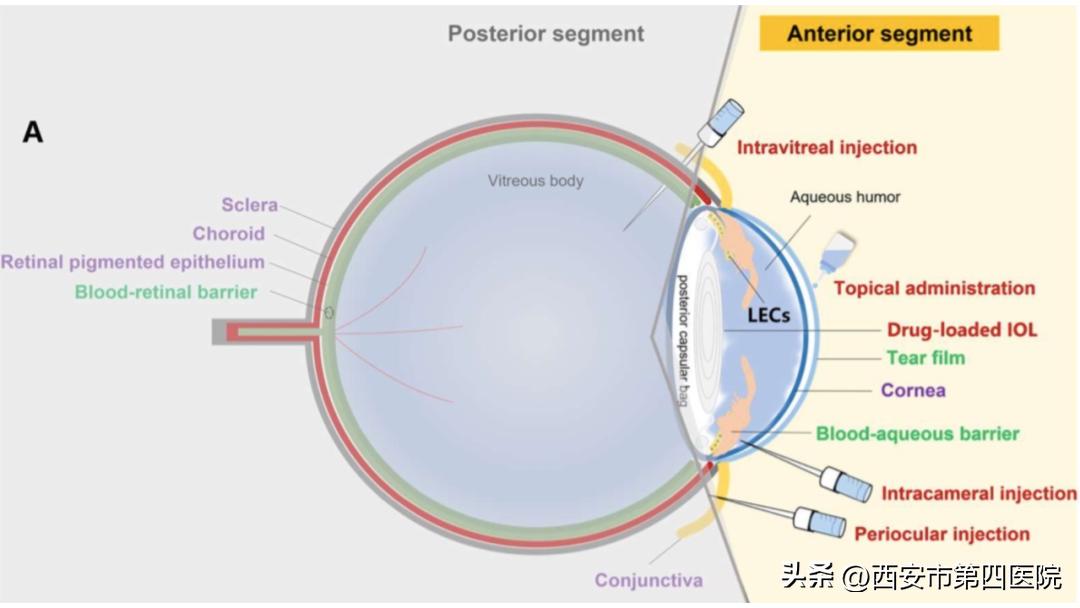 白内障药物治疗重大突破,药物治疗白内障最新研究成果