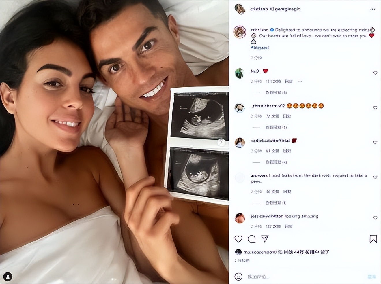 c罗龙凤胎儿子不幸夭折有谁安慰,c罗女友生了几胞胎