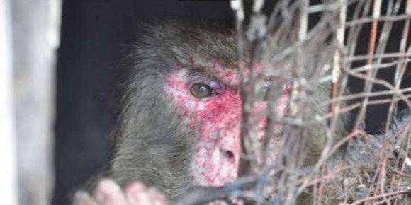 2013年,河北4岁男婴遭石头雨攻击,右手截肢奶奶怒骂:都是你害的