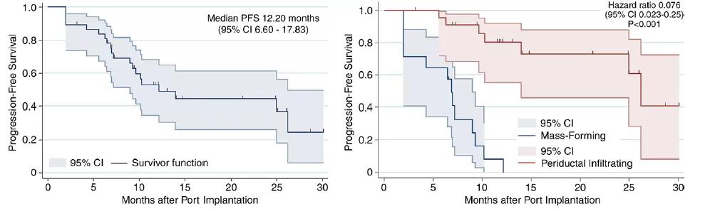 朱旭教授：肝脏介入治疗成为肝脏恶性肿瘤的一种重要治疗手段