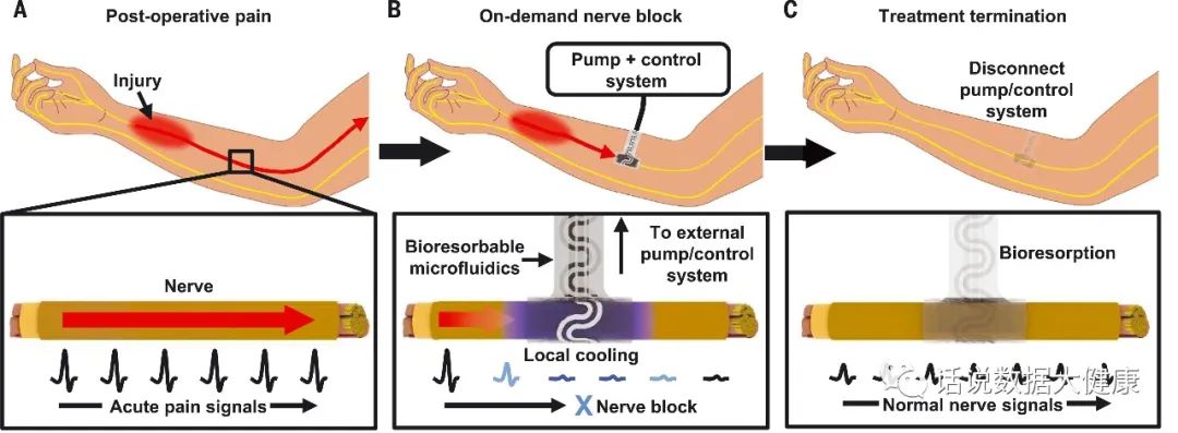 疼痛非药物治疗,疼痛无需再忍受