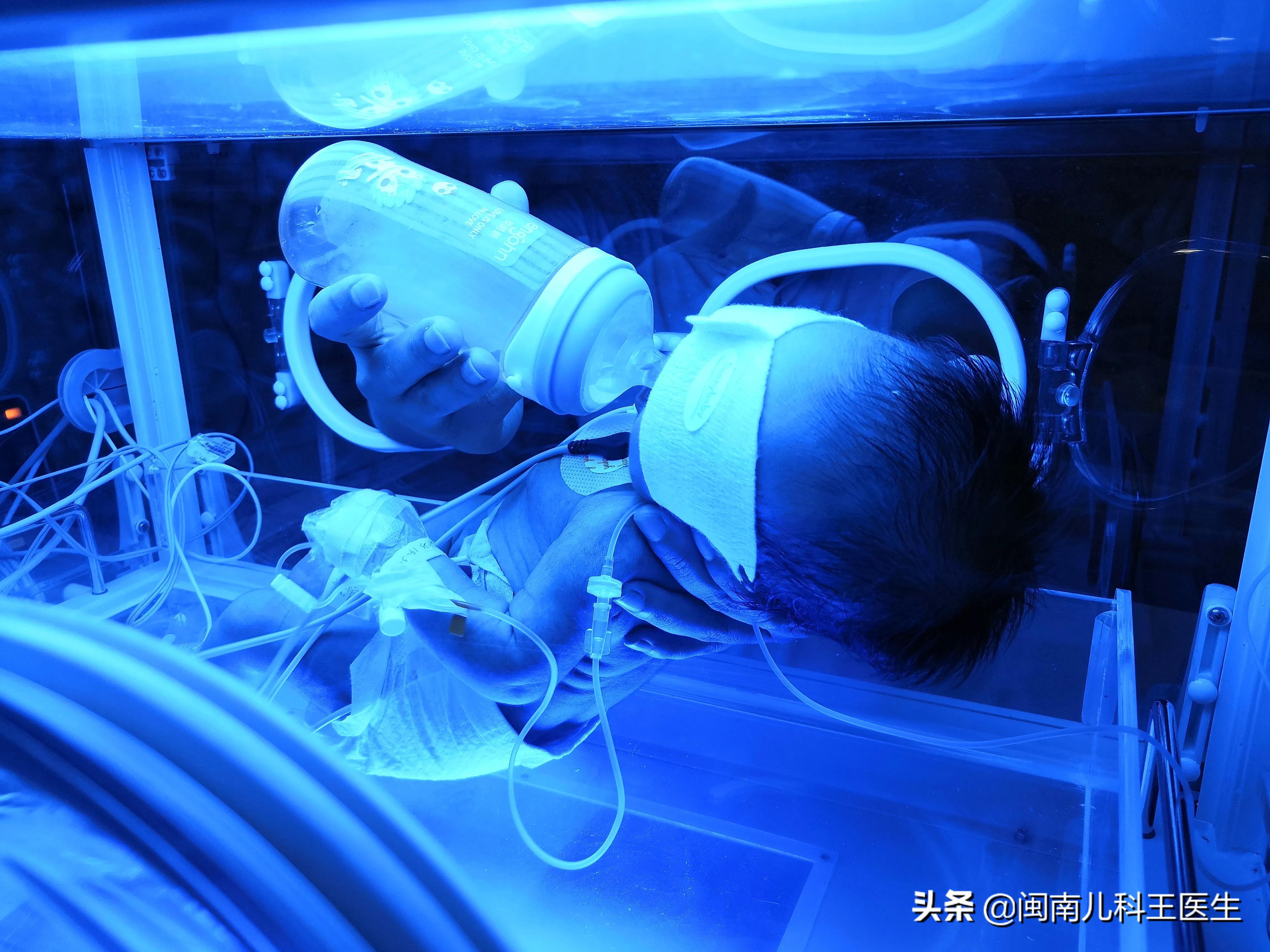 新生儿黄疸的6大误区,蓝光治疗新生儿黄疸是什么原理