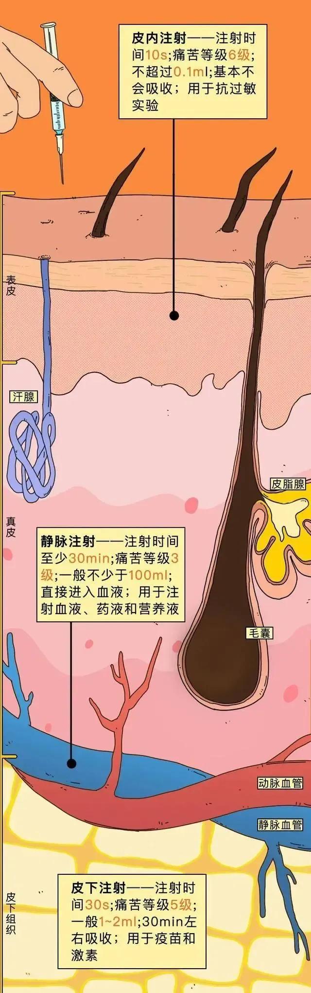 童年噩梦——“屁股针”，为啥那么痛？「漫画揭秘