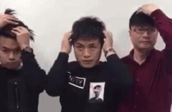 女生体毛多、长胡子、*处私**的毛又粗又长？或与这5个因素有关