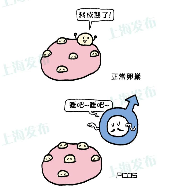 长痘、肥胖、月经不调，原来都是这个病造成的