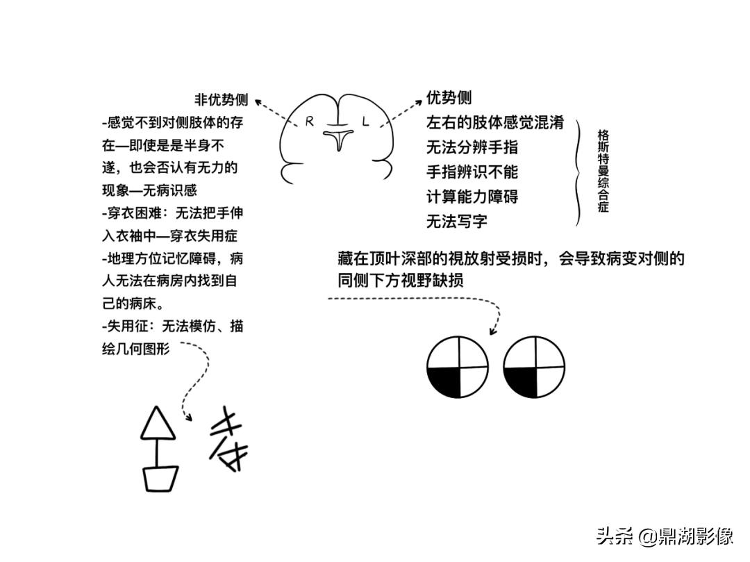 大脑皮层的解剖与定位,大脑解剖学习绘图笔记