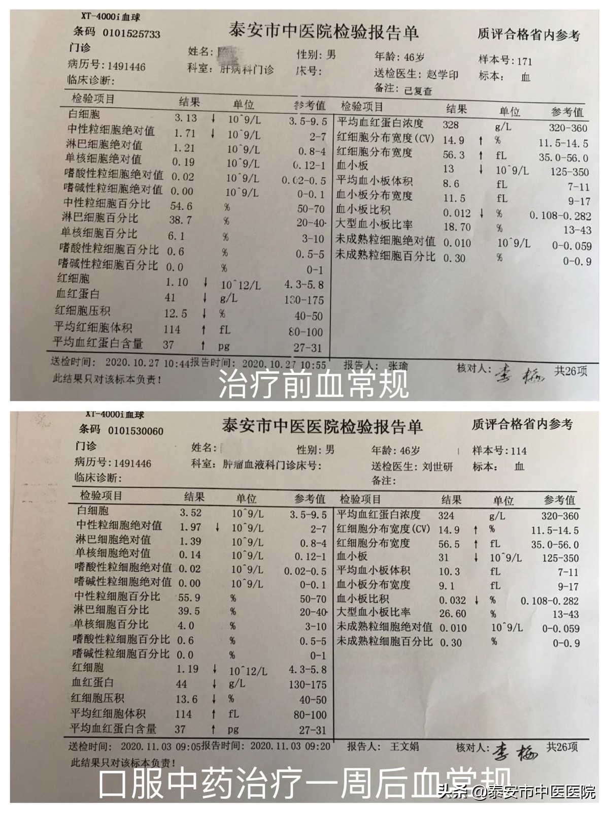 北京专家治疗贫血方法,贫血中医经方
