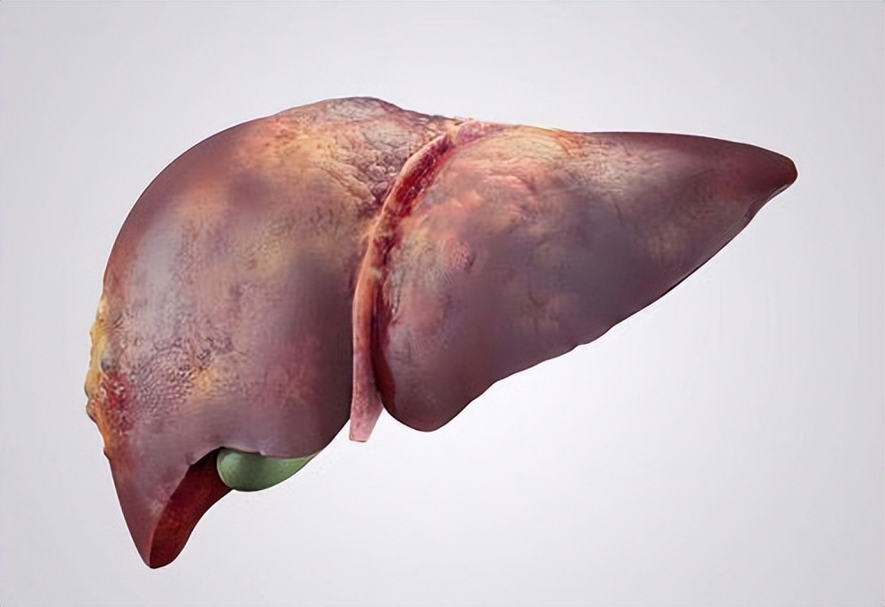 医生说有囊肿但不要紧,医生说有囊肿是什么意思