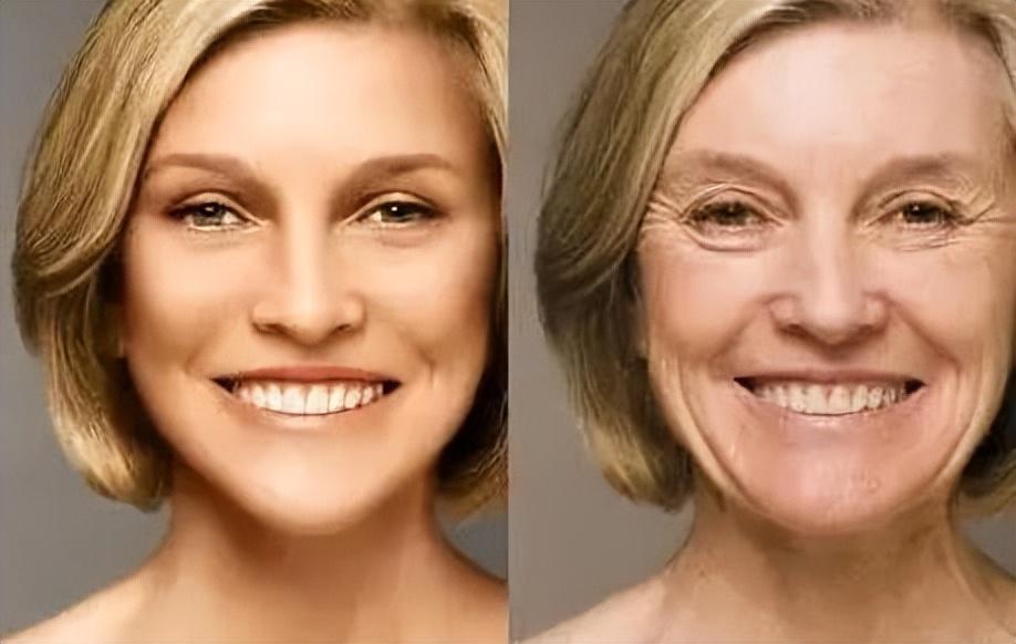 脸部皱纹分很多种，第一显老的是它？来看看如何“对症下药”