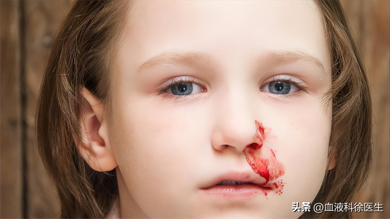 血友病：常被误认为“白血病”，血友病的症状有哪些？