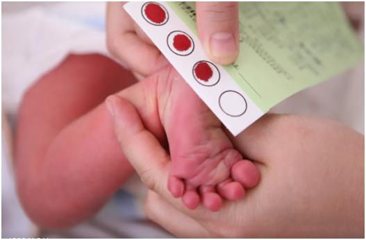 新生婴儿感觉身体软软没有力气,基因检测小胖威利综合症