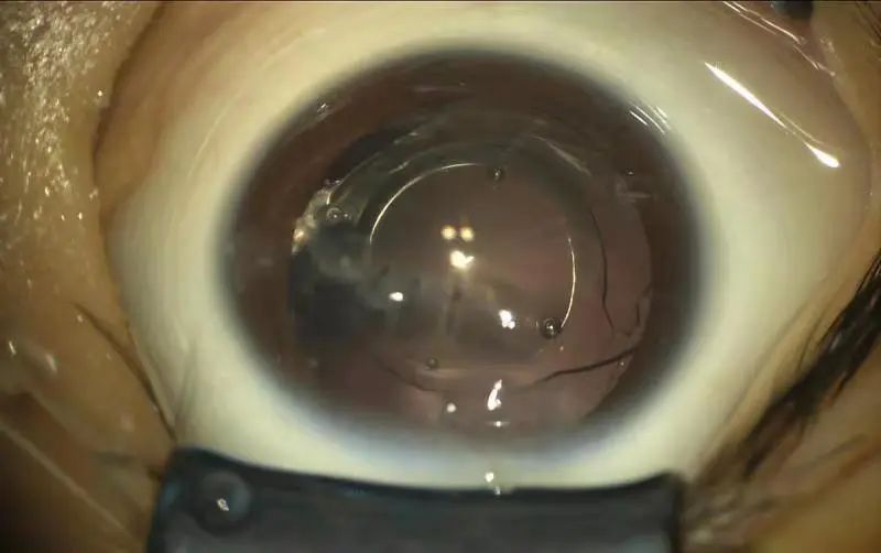 临沂妇幼保健院危急值,临沂市妇幼保健院儿童重症监护室